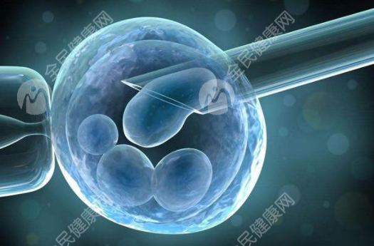 弱精畸形精子试管婴儿技术怎么样?