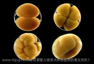 做试管婴儿做多次卵泡监测的意义何在？