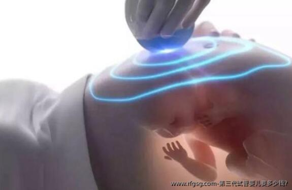 第三代试管婴儿要多少钱?