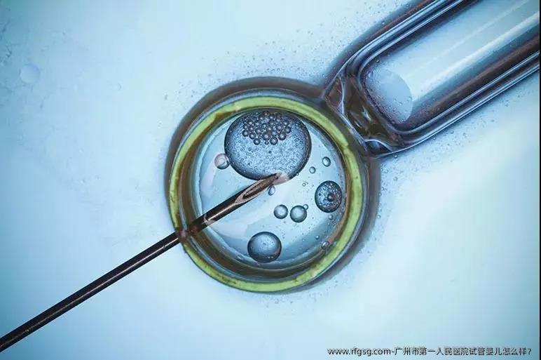 广州市第一人民医院试管婴儿怎么样？