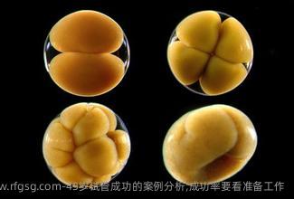 43岁试管成功的案例分析,成功率要看准备工作