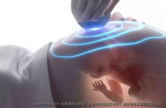 去泰国做试管婴儿的具体流程是怎样的？高龄能做泰国试管婴儿吗？