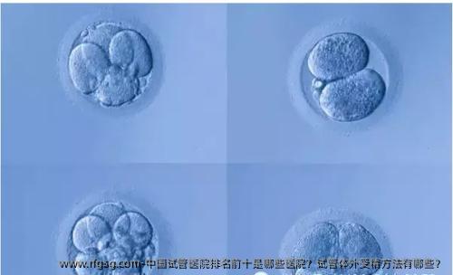 中国试管医院排名前十是哪些医院？试管体外受精方法有哪些？