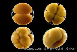 肇庆试管婴儿费用多少钱