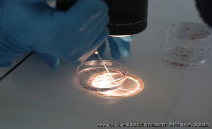 试管婴儿为何要用腹腔镜？两种情况分析，速览原因
