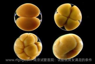 南京试管医院：试管挑男女满足的条件