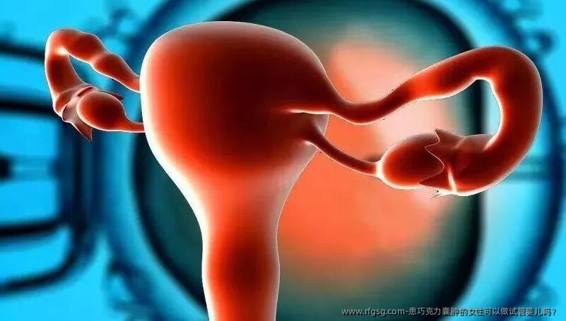患巧克力囊肿的女性可以做试管婴儿吗？