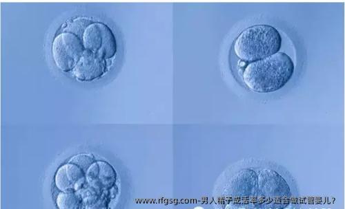 男人精子成活率多少适合做试管婴儿？