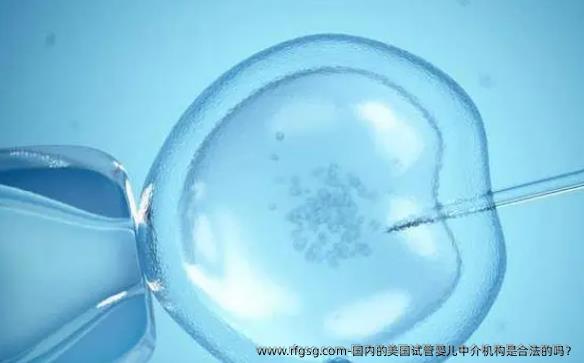 国内的美国试管婴儿中介机构是合法的吗？