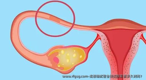 成都做试管全部过程需要多久时间？