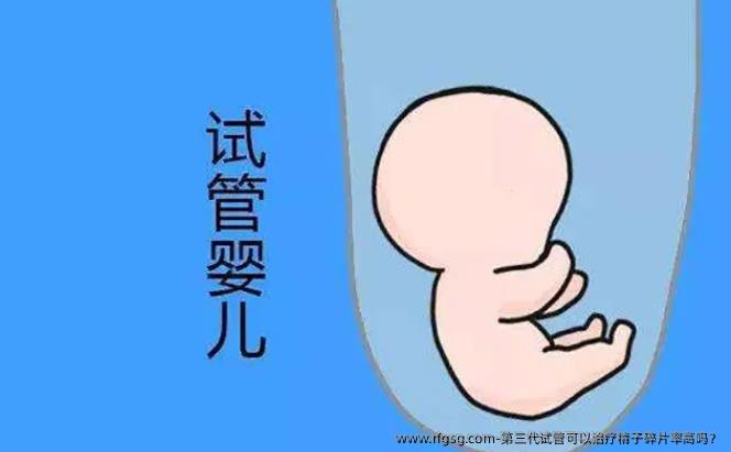 第三代试管可以治疗精子碎片率高吗？