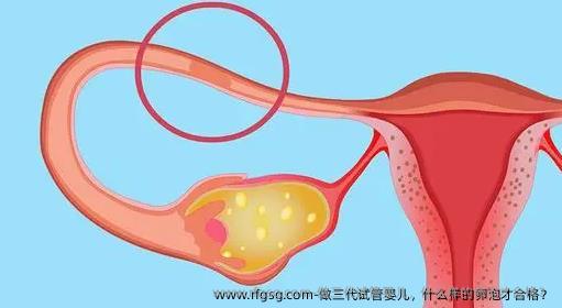 做三代试管婴儿，什么样的卵泡才合格？