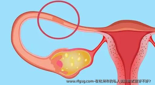 在杭州市的私人医院做试管好不好？