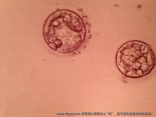 试管婴儿费用这么“高”，是不是代表成功率也很高？