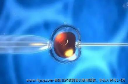 泰国三代试管婴儿费用揭露，折合人民币2-4万