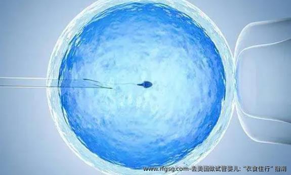 去美国做试管婴儿:“衣食住行”指南