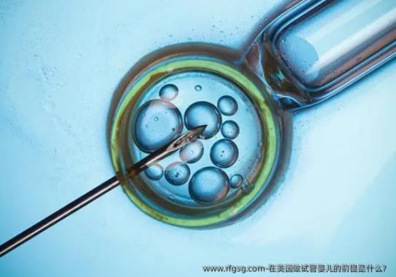 在美国做试管婴儿的前提是什么？