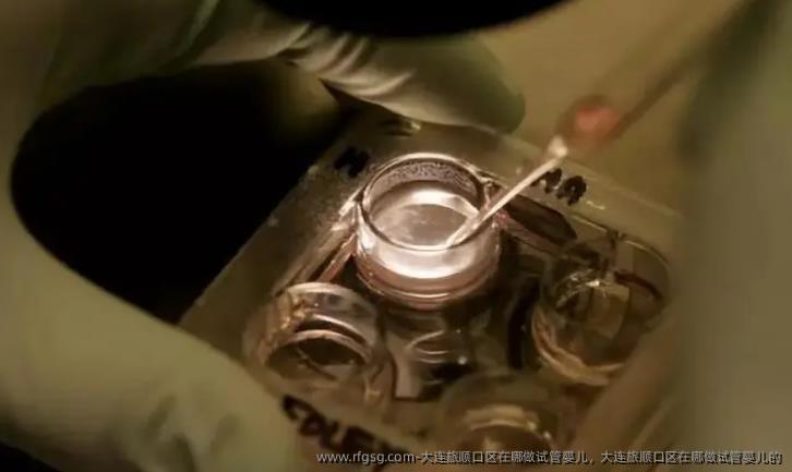 大连旅顺口区在哪做试管婴儿，大连旅顺口区在哪做试管婴儿的