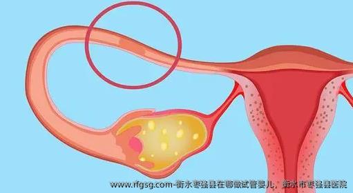 衡水枣强县在哪做试管婴儿，衡水市枣强县医院