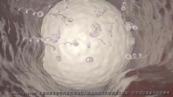 多囊卵巢不孕在内蒙古自治区人民医院做三代试管婴儿指南！怀孕成功率多少供您参考