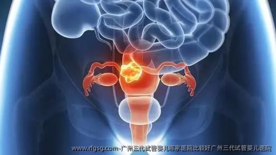 广州三代试管婴儿哪家医院比较好广州三代试管婴儿医院