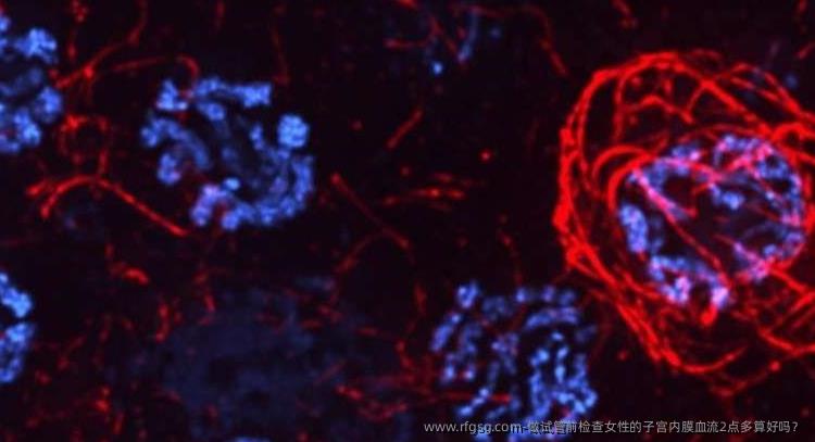 做试管前检查女性的子宫内膜血流2点多算好吗？