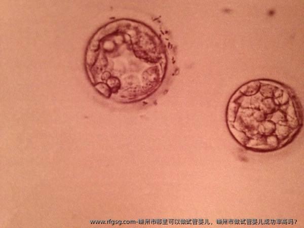 嵊州市哪里可以做试管婴儿，嵊州市做试管婴儿成功率高吗？
