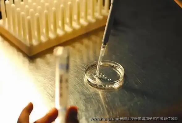 长期上夜班或增加子宫内膜异位风险 