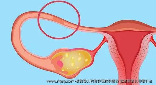 试管婴儿的具体流程有哪些 做试管婴儿需要什么 
