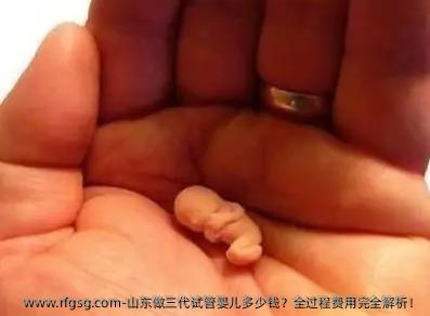 山东做三代试管婴儿多少钱？全过程费用完全解析！