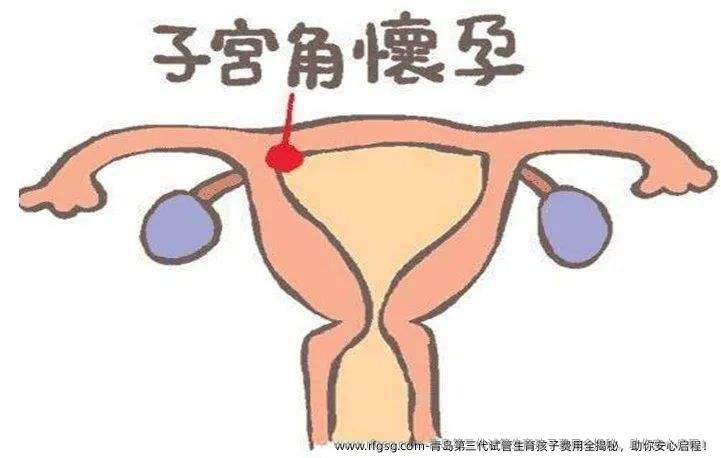青岛第三代试管生育孩子费用全揭秘，助你安心启程！