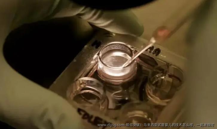 帮你突破！马来西亚试管婴儿的技术怎么样，一起来探讨