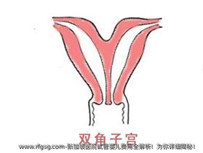 新加坡医院试管婴儿费用全解析！为你详细揭秘！