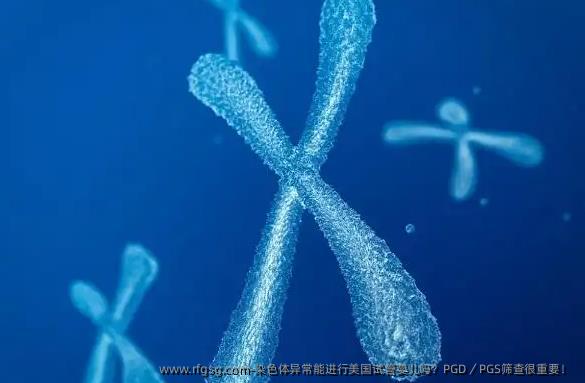 染色体异常能进行美国试管婴儿吗？PGD／PGS筛查很重要！ 