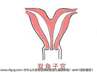 为什么大家都选择试管婴儿囊胚移植？amh1促排囊胚？ 