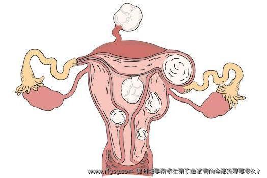 锦州妇婴南桥生殖院做试管的全部流程要多久？