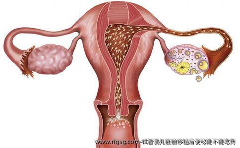试管婴儿胚胎移植后便秘能不能吃药