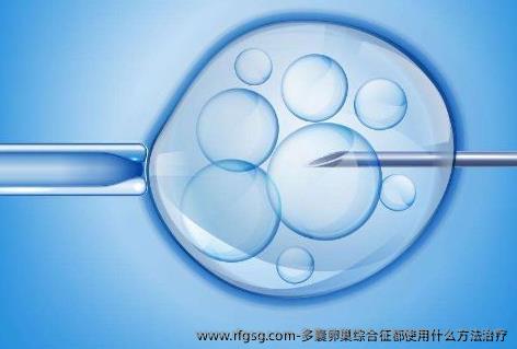 多囊卵巢综合征都使用什么方法治疗