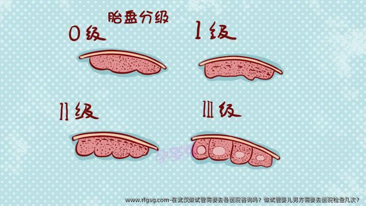 在武汉做试管需要去各医院咨询吗？做试管婴儿男方需要去医院检查几次？