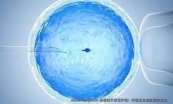 卓越技术保驾护航！玛祖医生做试管的实力：