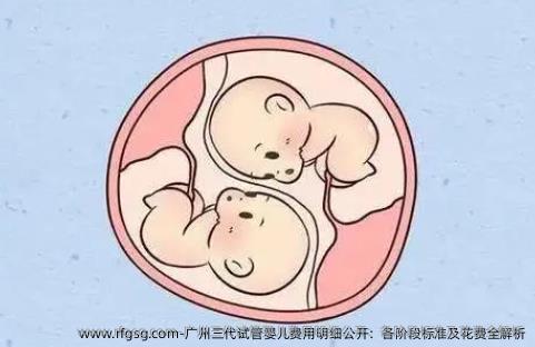 广州三代试管婴儿费用明细公开：各阶段标准及花费全解析