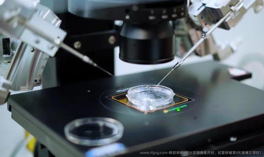 鲜胚移植8天出现腹痛像月经，试管移植第8天腹痛正常吗?