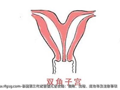 泰国第三代试管婴儿全攻略：费用、流程、成功率及注意事项