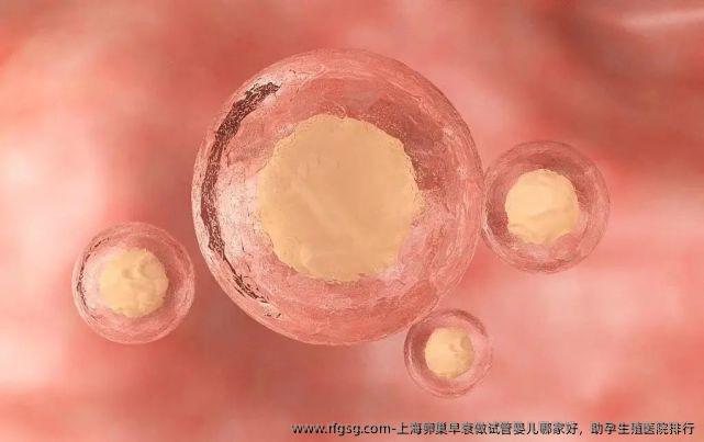 上海卵巢早衰做试管婴儿哪家好，助孕生殖医院排行