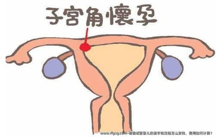 莆田试管婴儿的要求和流程怎么安排，费用如何计算？