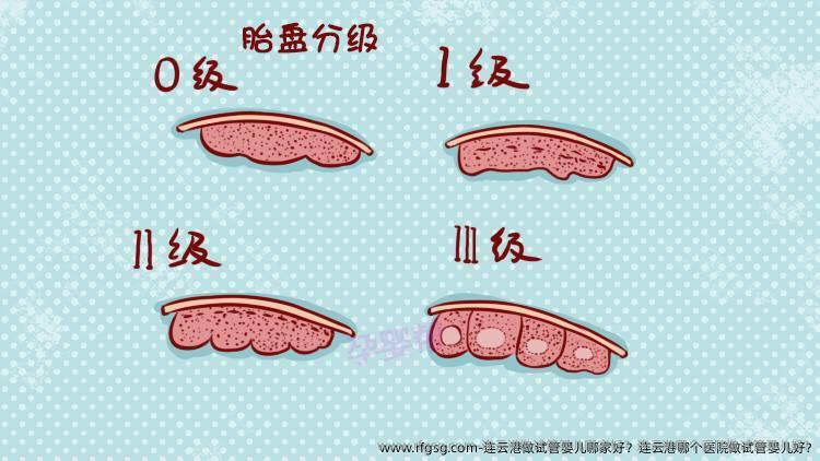 连云港做试管婴儿哪家好？连云港哪个医院做试管婴儿好?