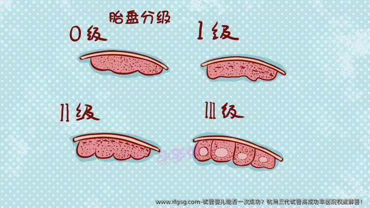 试管婴儿能否一次成功？杭州三代试管高成功率医院权威解答！