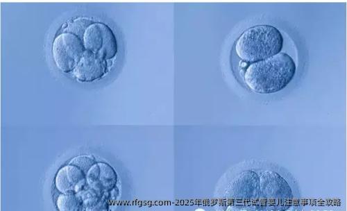 2025年俄罗斯第三代试管婴儿注意事项全攻略