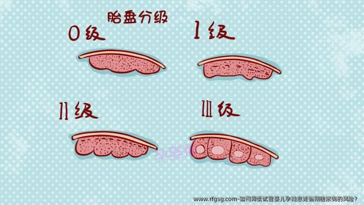 如何降低试管婴儿孕妇患妊娠期糖尿病的风险？