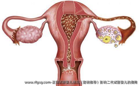 正规试管婴儿医院（昆明推荐）影响二代试管婴儿的费用